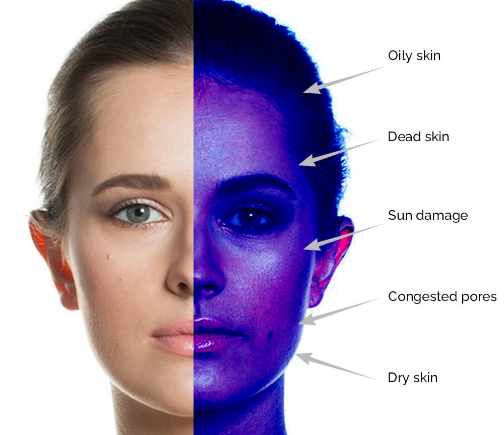 What is Skin Analysis, Why is it Important?