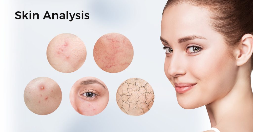 What is Skin Analysis, Why is it Important?