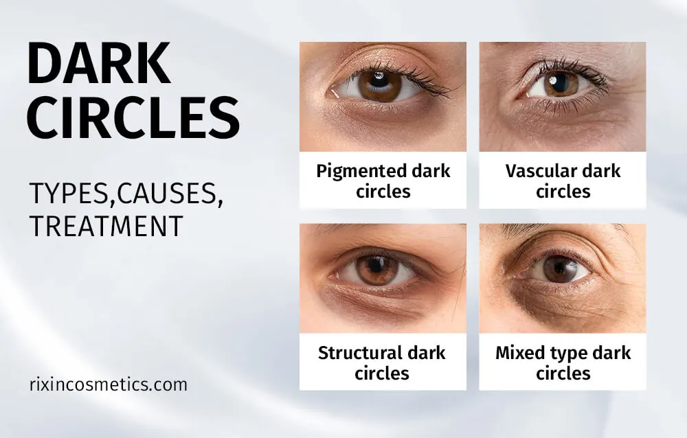 Dark Circle Ingredients: A Comprehensive Guide for 2025